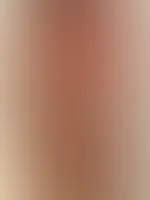 Red ❤️🔥