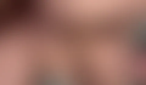 Löffelchenstellung