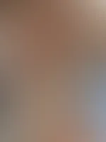 Neon grüner Bikini in Schlangen Optik an mir