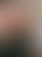 Egal wie viel ich mich eincreme, irgendeine stelle vergesse ich trotzdem immer -.-