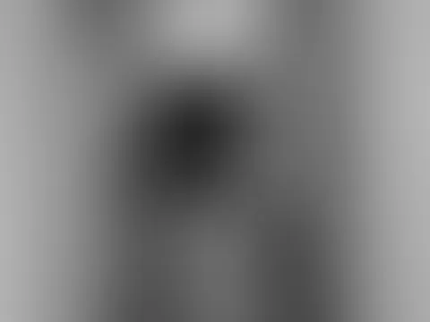 XXL Bilder Paket