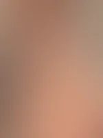 Nackt die Sonne genießen ☀️