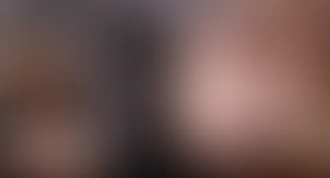 Kleine süße Zuckerkirschen 🍒