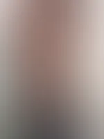 Body naked
