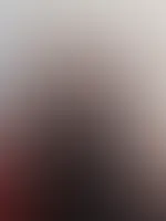 Möchtest du mir was durch die Maulsperre in den Mund schieben
