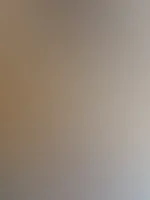 Was man nicht alles macht für gute Bilder für euch naja hoffentlich hilft die Schmerzspritze 😢