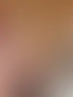 Leicht angekokelt, aber hey, Hauptsache Sonne!