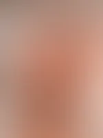 Du hast mir den Kopf verdreht