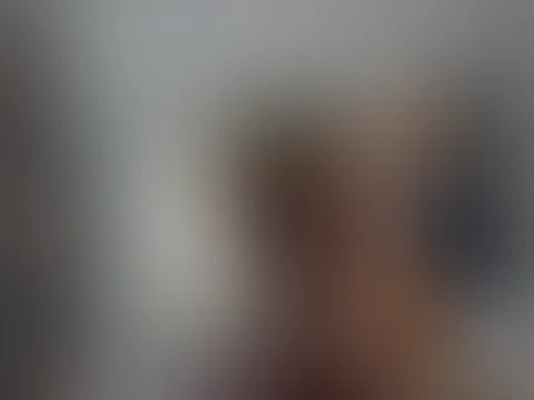 Autsch....🔥🔥kannst du mir beim eincremen helfen?🥵