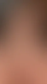 Intim während der Livesession. Das war 🔥. Schaut mal meine Wunde M**e😮💨
