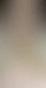 Kuss auf die Augen! Nur welche? 😇