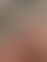 Ich bin verletzt wer hilft mir mich zu waschen