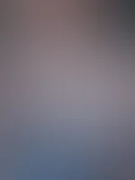 Sonnenbrand kommst du mich eincremen?