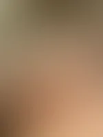 Schuldig im Sinne der Anklage: Drei-Loch-Stute