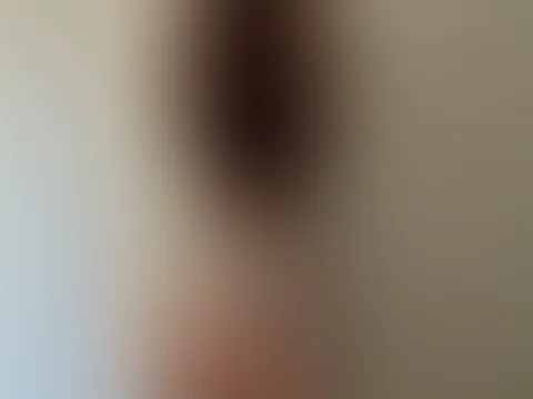 🙈✨