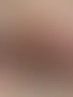 🥵