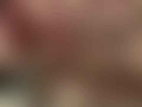 Milchtitten quetschen