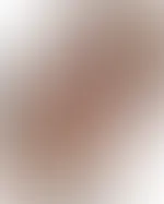 Hier mal der Vergleich nach meiner Beustvergrößerung