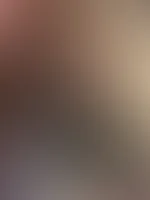 🔥