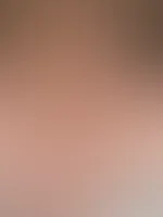 Haarige Angelegenheit