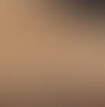 Welche Körperstelle ist das? Titten oder A***h? 😜