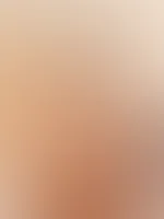 Bitte
