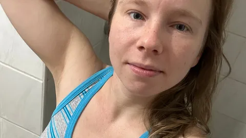 Long labia