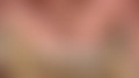 Dilator and  S****t