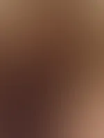 M****i
