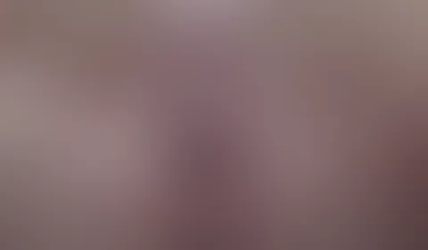 Vagina spreading and stretching