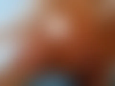 A**l