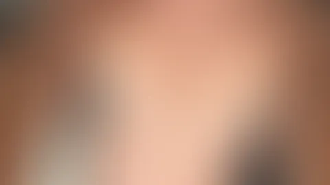 Kisses