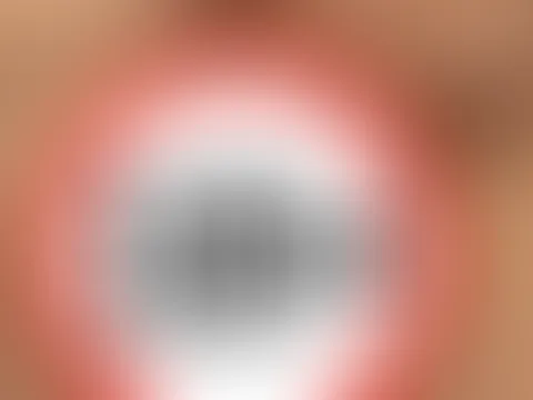 Private Access Fingern
