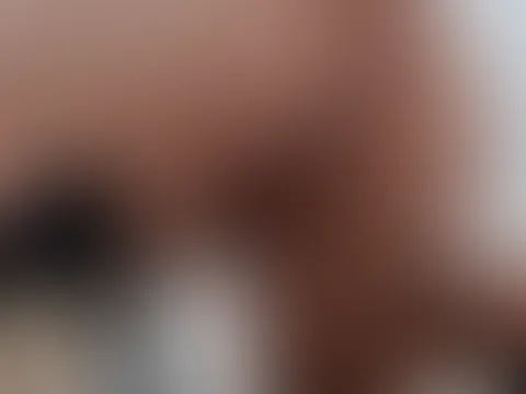 A**l