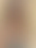 Lieber mit, oder ohne Brille? đ€đ
