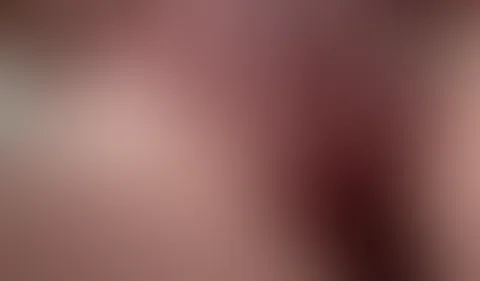 Fingern