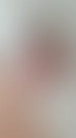 Aa
