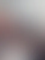 Oben ohne auf dem Zahnarzt Stuhl .. 🤤