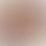 50 kg Gewicht verloren und meine Brüste straffen lassen… mega stolz auf meine Leistung. Welches Bild gefällt dir mehr? 💋