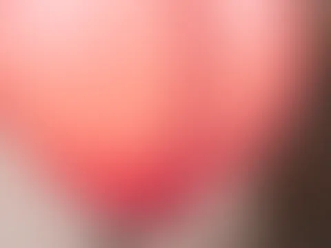 A**l