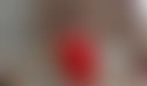Poolboy verteilt Korb, jetzt muss ich selbst ran