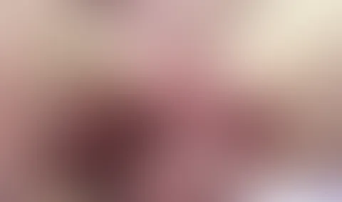 fingern