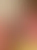 Wo kommen immer diese blauen Flecken her? 🥴