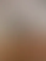 Naaa