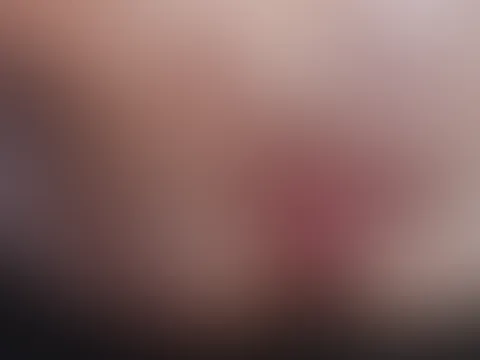 M****i-Bilder