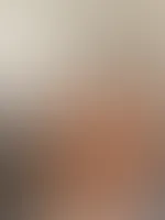 Doggy View