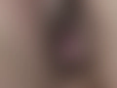 A**l