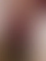 Rot