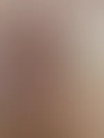 Eis