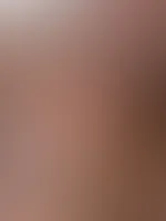 Kleiner Nippeltwist gefällig?